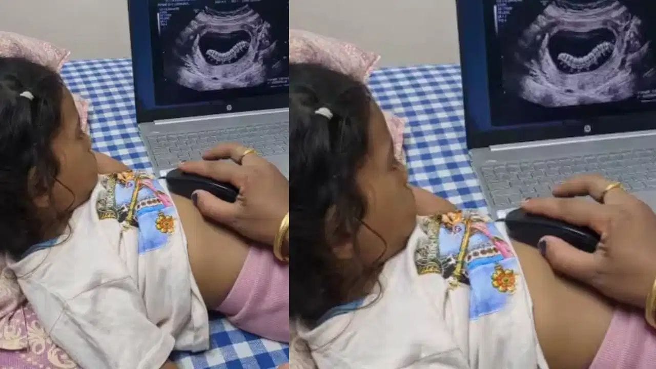 Trending Video : શું તમારું બાળક પણ વધારે ફાસ્ટફુડ ખાય છે, તો આ વીડિયો તમે ખાસ જોઈ લેજો