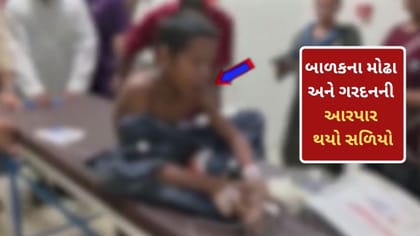 સુરતમાં હચમચાવતી ઘટના! 13 વર્ષના કિશોરની ગરદનમાંથી આરપાર થયો સળિયો