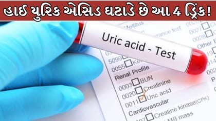 હાઈ યુરિક એસિડ ઘટાડવામાં અસરકારક છે આ 4 ડ્રિંક !