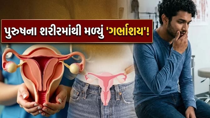 પુરુષના શરીરમાં ગર્ભાશય? જાણો આ ઘટના પાછળનું 'વિજ્ઞાન'