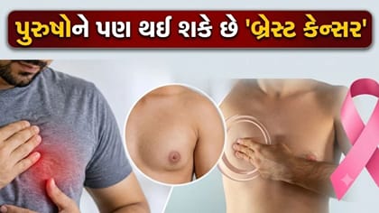 મહિલાઓને જ નહીં, પુરુષોને પણ થાય છે 'બ્રેસ્ટ કેન્સર'