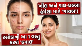 ચહેરા પરના કાળા ડાઘ અને ખીલ 3 દિવસમાં થશે ‘ગાયબ’, બસ રસોડામાં રહેલી આ 1 વસ્તુ લગાવવાનું શરૂ કરો