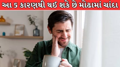 આ 5 કારણથી વારંવાર થઈ શકે છે મોઢામાં ચાંદા