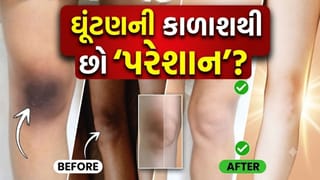 ઘૂંટણની કાળાશ કેવી રીતે ઓછી કરવી ? ડાર્કનેસ દૂર કરવા માટે શું લગાવવું જોઈએ? જાણો દૂર કરવાની ‘સિક્રેટ ટિપ્સ’