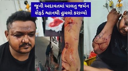 જૂની અદાવતમાં પાલતુ જર્મન શેફર્ડ શ્વાનથી બચકા ભરાવ્યા, યુવાન ઈજાગ્રસ્ત