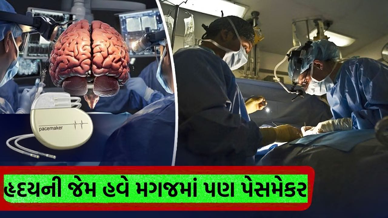 હૃદયની જેમ હવે મગજમાં પણ પેસમેકર… દિલ્હીની RML હોસ્પિટલમાં પહેલીવાર થઈ ડીપ બ્રેઇન સર્જરી