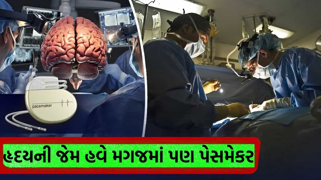 હૃદયની જેમ હવે મગજમાં પણ પેસમેકર… દિલ્હીની RML હોસ્પિટલમાં પહેલીવાર થઈ ડીપ બ્રેઇન સર્જરી