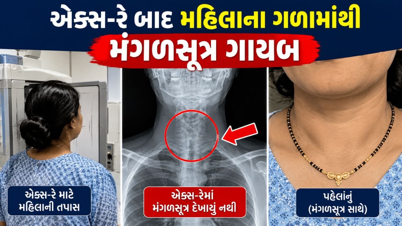 સુરતમાં નવી સિવિલ હોસ્પિટલમાં એક્સ-રે બાદ મૃતક મહિલાના ગળામાંથી મંગળસૂત્ર ગાયબ