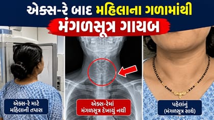 એક્સ-રે બાદ મહિલાના ગળામાંથી મંગળસૂત્ર ગાયબ , જુઓ વીડિયો