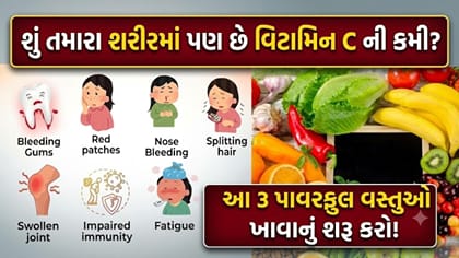 આ 3 વસ્તુ ખાવાથી ચપટીમાં દૂર થશે વિટામિન C ની સમસ્યા