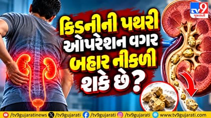 કિડની સ્ટોન: કઈ સાઇઝમાં ઓપરેશન જરૂરી? જાણો સાચો નિયમ