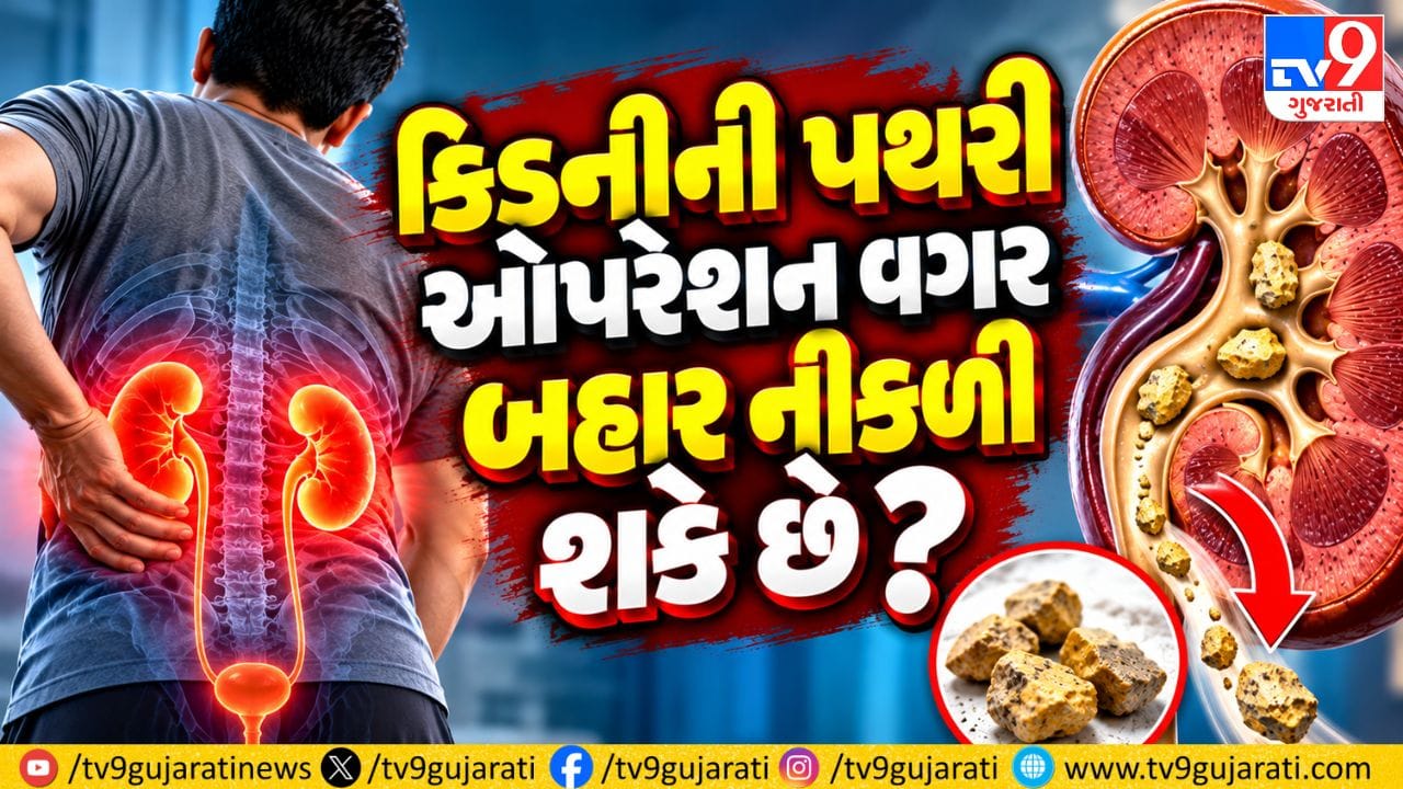 ઓપરેશન વગર પણ નીકળી શકે છે કિડનીની પથરી, જાણો કેટલા mmની પથરીમાં સર્જરી જરૂરી અને ક્યારે દવા-પાણીથી થાય છે ઈલાજ !