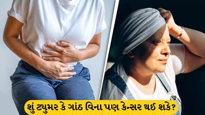 ગાંઠ વિના પણ થઈ શકે છે કેન્સર: જાણો પેરીટોનિયલ શું છે