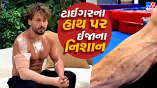 Tiger Shroff Firing : ગનપાઉડર અને કારની બારીના કાચથી ટાઈગરના હાથ પર થઈ ઈજા, માતાએ શેર કરી તસવીર