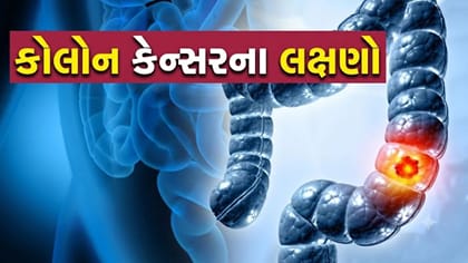 શરીરમાં દેખાતા આ બદલાવો બની શકે છે કોલોન કેન્સરનું કારણ